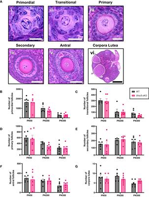 Xrcc5/KU80 is not required for the survival or activation of prophase-arrested oocytes in primordial follicles